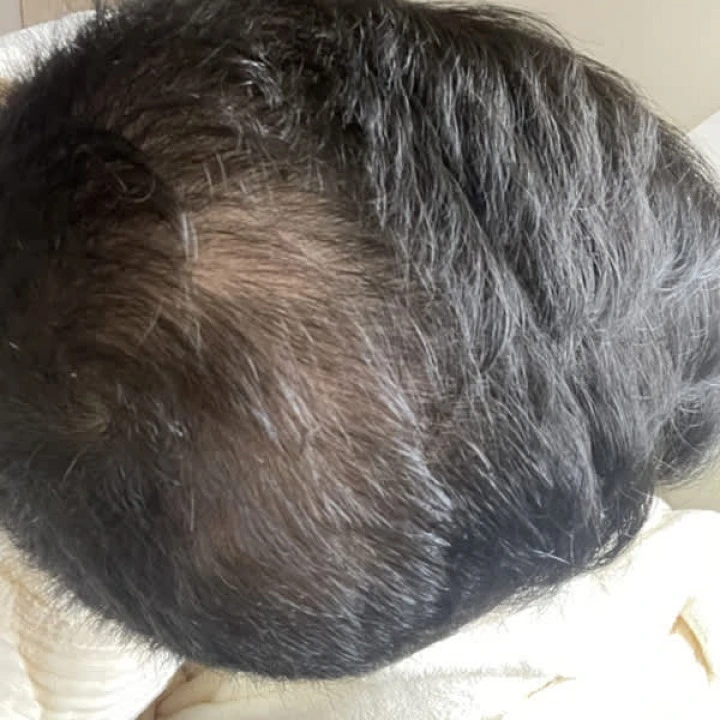 Odżywka zagęszczająca włosy z palmą sabałową, rozmarynem, biotyną, B3, B5, Avalon Organics