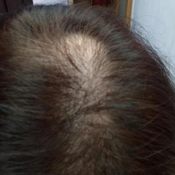 Witaminy na włosy Maxi-Hair Plus z biotyną 5000 μg, 120 kaps, Country Life