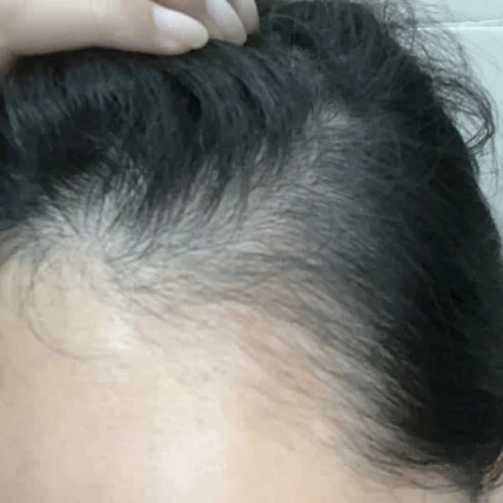 Tonik przeciw wypadaniu i AGA z miętą, palmą sabalową, biotyną i rozmarynem Folligen, Dr.ForHair
