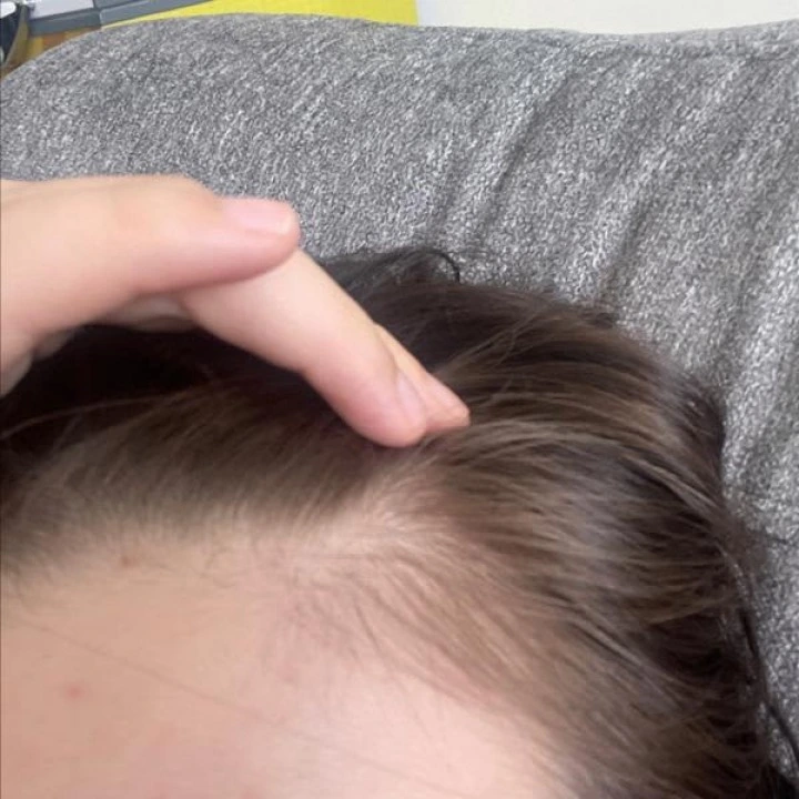 Tonik przeciw wypadaniu i AGA z miętą, palmą sabalową, biotyną i rozmarynem Folligen, Dr.ForHair