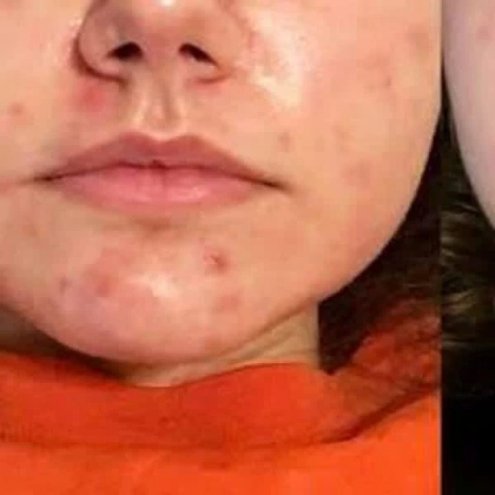 Olej z nasion dzikiej róży do stymulacji wzrostu włosów i pielęgnacji skóry, Life-flo