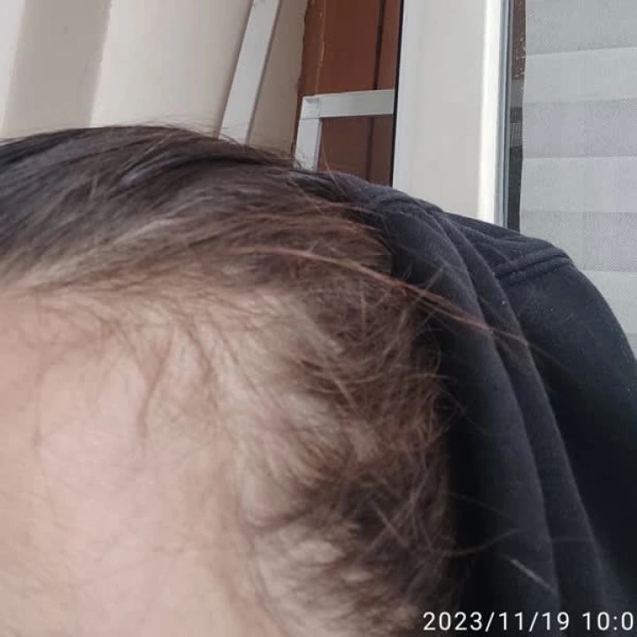 Магниевое масло для стимуляции фолликулов и роста новых волос, Life-flo