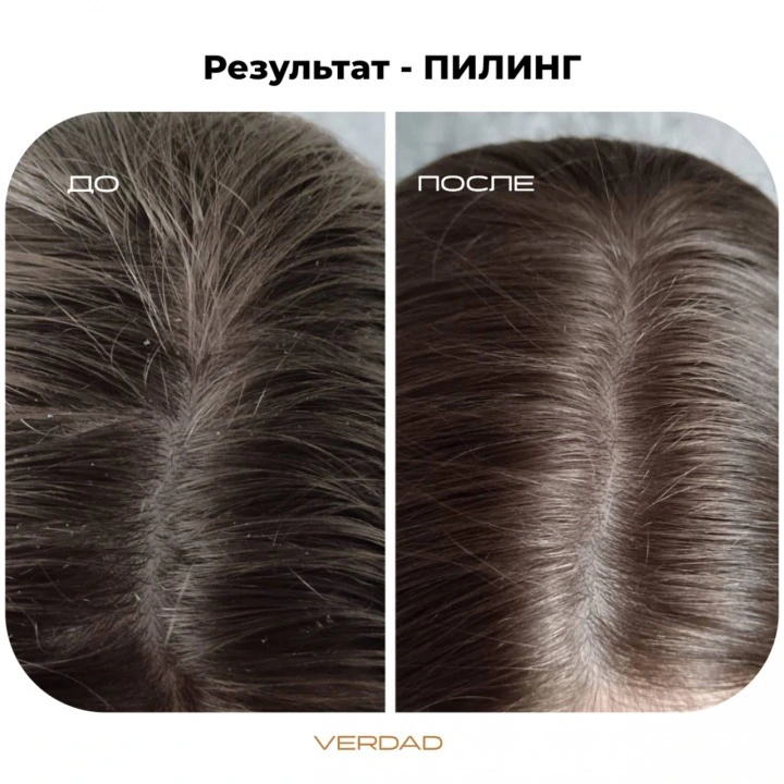 Пилинг-маска для очищения кожи головы и активации роста новых волос, Verdad