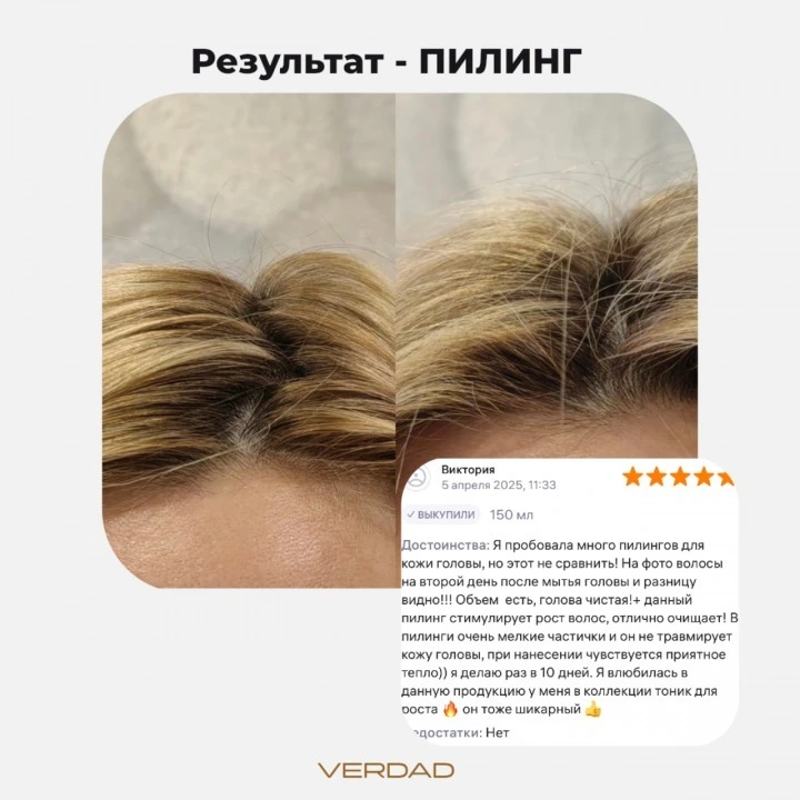 Пилинг-маска для очищения кожи головы и активации роста новых волос, Verdad