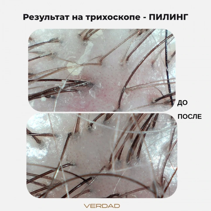 Пилинг-маска для очищения кожи головы и активации роста новых волос, Verdad
