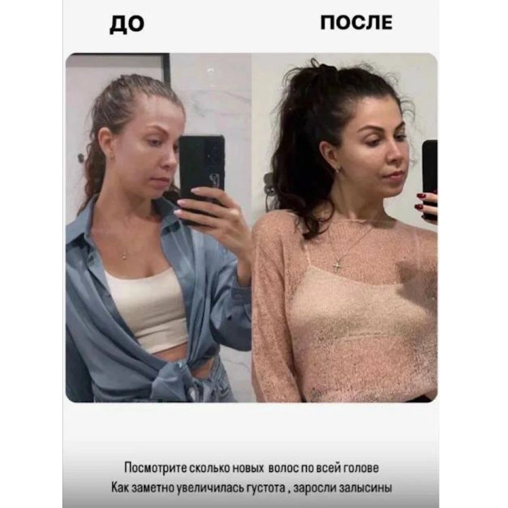 Сыворотка-концентрат от выпадения волос с Capixyl, розмарин, цинк, медь, НАБОР 2 уп, Verdad
