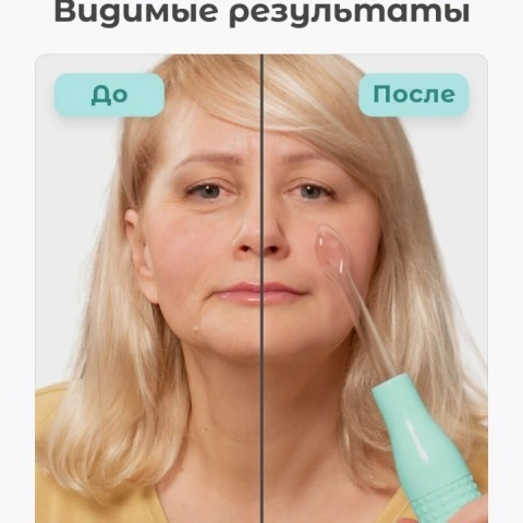 Дарсонваль BP-7000 для волос, лица и тела с 5 насадками, зеленый, Gezatone