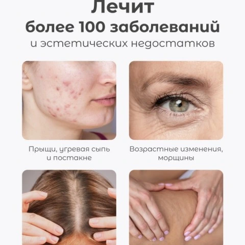 Дарсонваль Biolift4 118 для волос, лица и тела, 4 насадки, белый, Gezatone