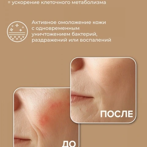 Дарсонваль для роста волос, лица и тела с 5 насадками, белый, HoneyCare 