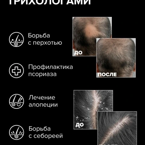 Микротоковая расческа 3 в 1 с LED-светотерапией, RF-терапией для роста волос, HoneyCare