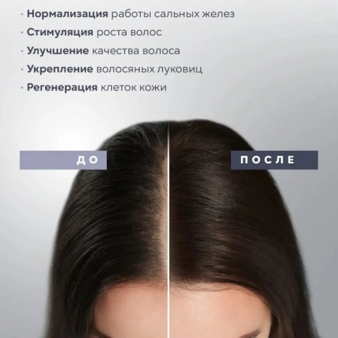 Расческа-массажер 3 в 1 с LED-светотерапией, EMS-микротоками, ION-терапией, Asia Care