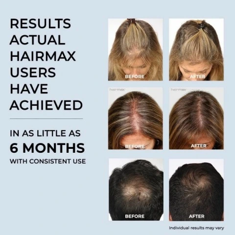 Лазерная оригинальная расческа для роста волос LaserComb Prima 7, HairMax