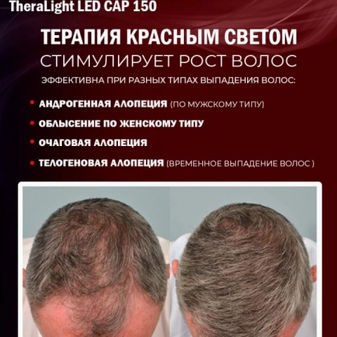Аппарат-кепка для фототерапии LED, активации роста новых волос LED Cap 150, TheraLight