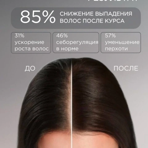 Микротоковая массажная LED-расческа с ультразвуком, уход 5 в 1, Luminel PRO