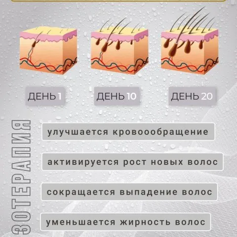 Дермароллер для активации и повышения густоты волос с позолоченными иглами, Wheneva